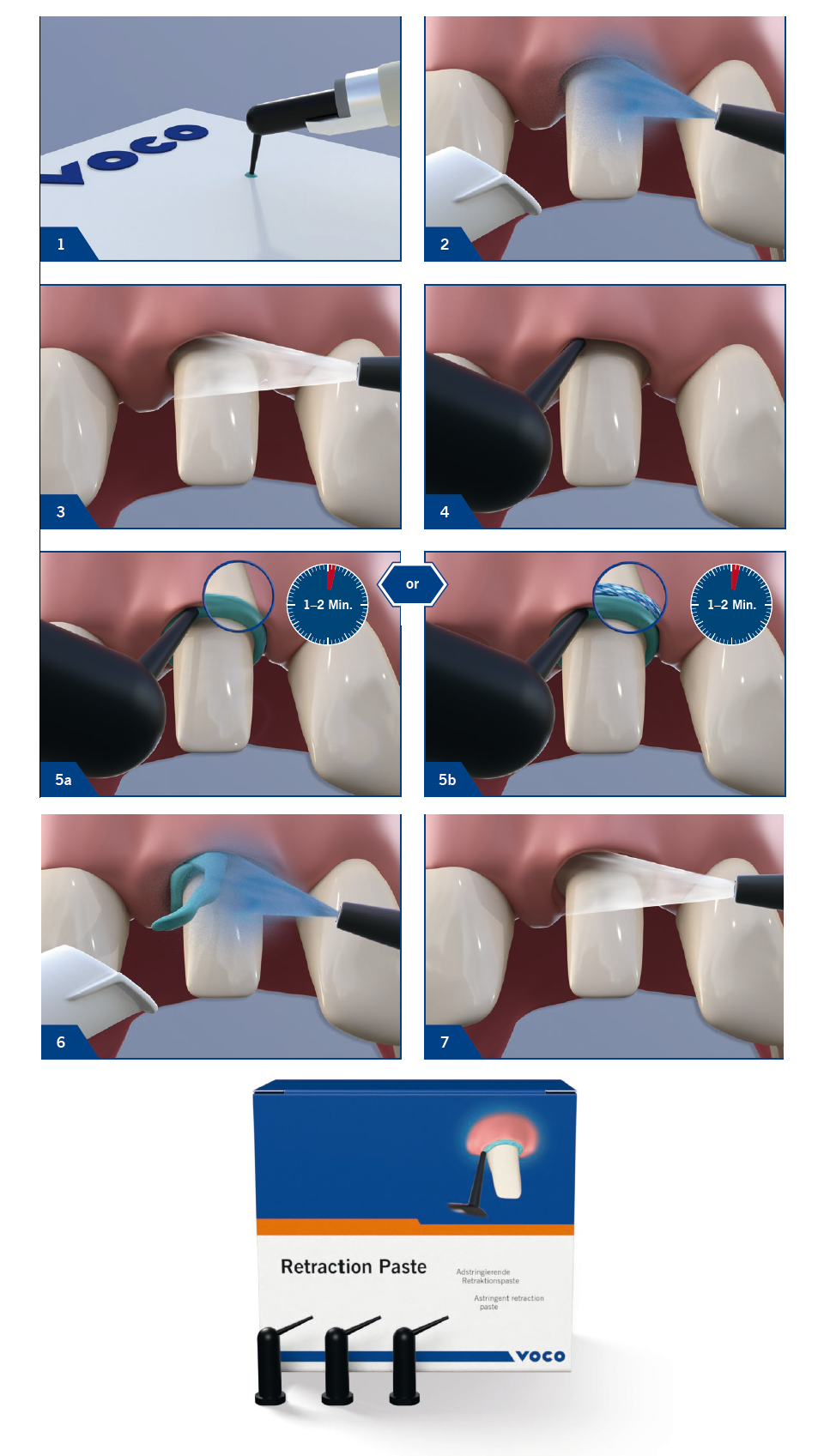 Voco Retraction Paste